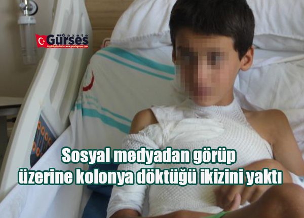 Sosyal medyadan görüp üzerine kolonya döktügü ikizini yakti